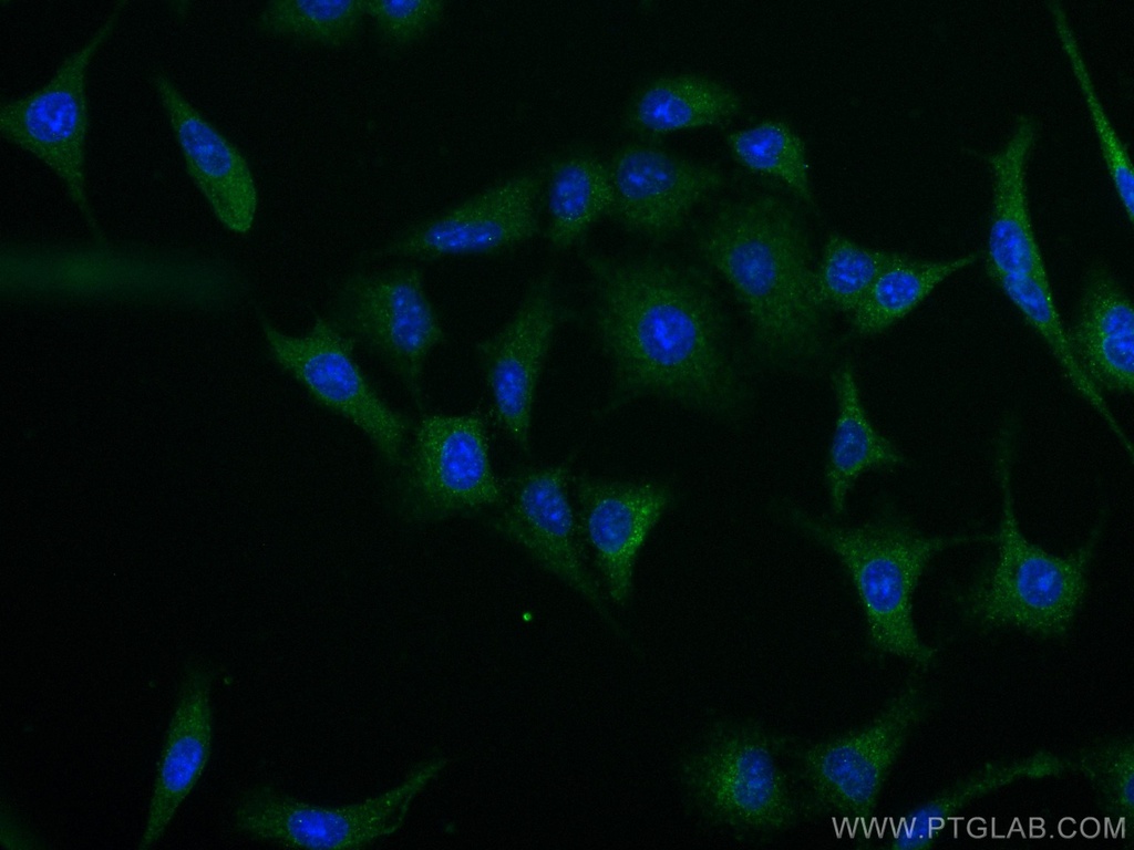 IMPDH2 Monoclonal antibody