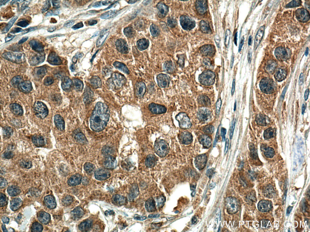 EIF2AK1 Monoclonal antibody