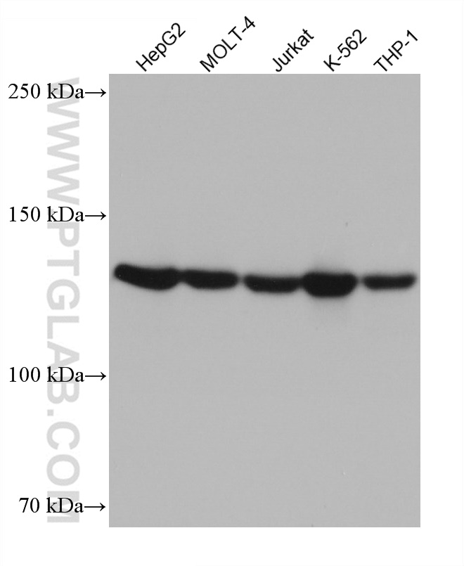 ESYT1 Monoclonal antibody