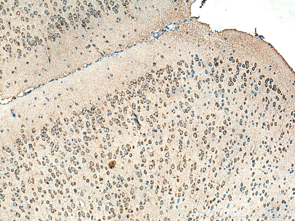 ALPK1 Monoclonal antibody