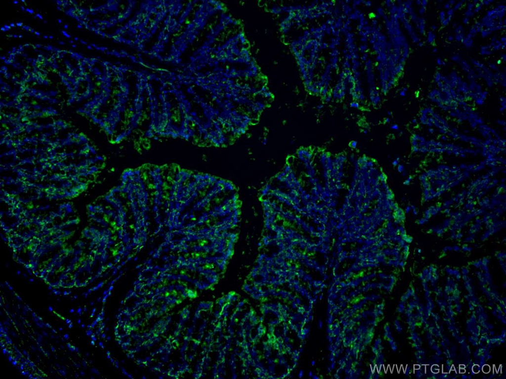 FABP2 Monoclonal antibody