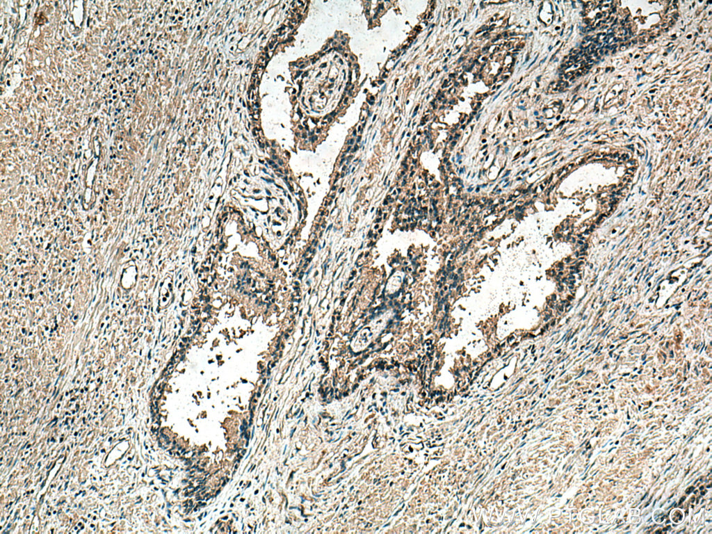 MAP3K7 Monoclonal antibody