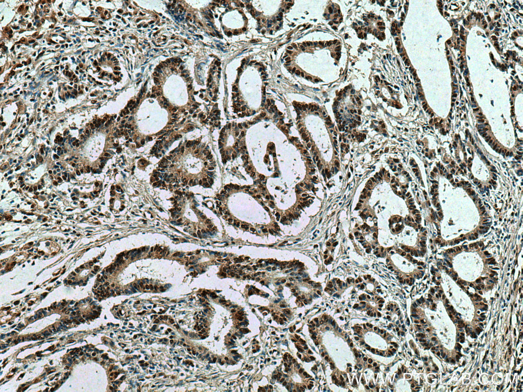 HNRNPK Monoclonal antibody