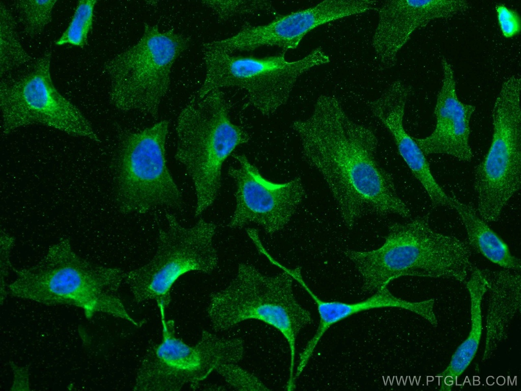 EPRS Monoclonal antibody