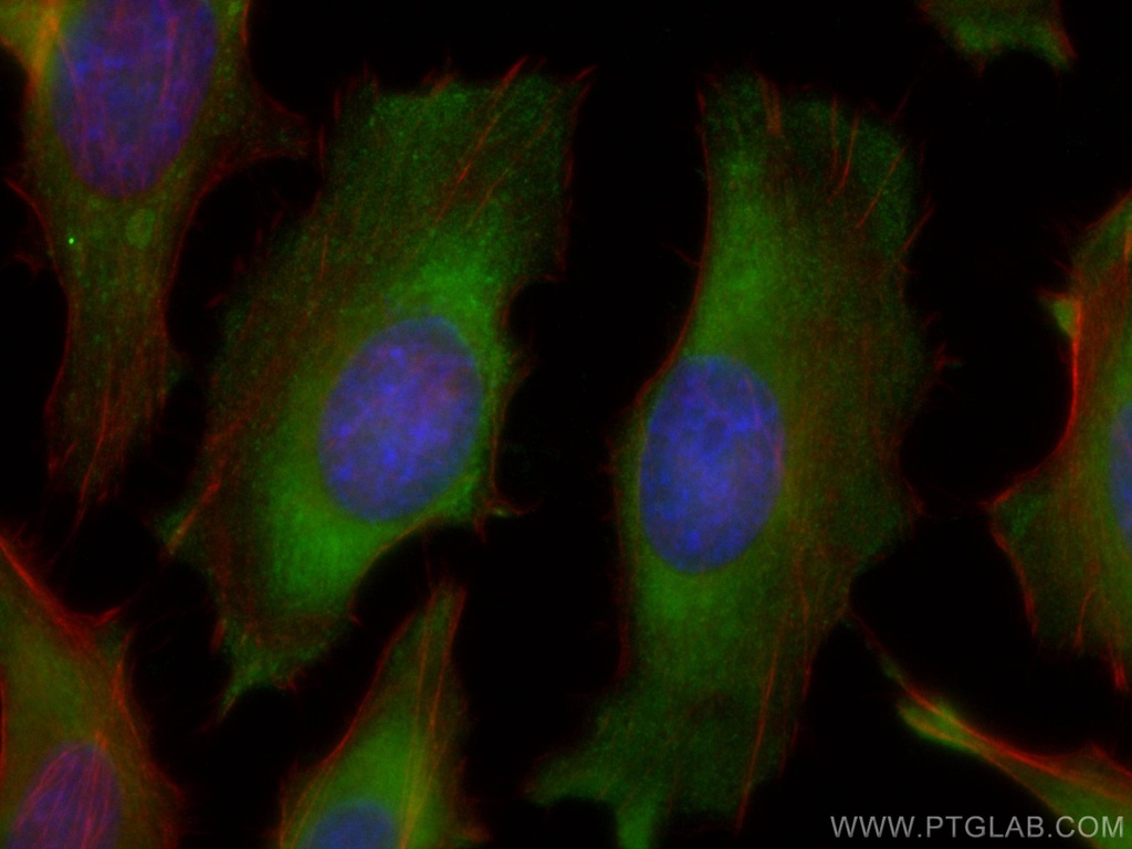 TXNRD1 Monoclonal antibody