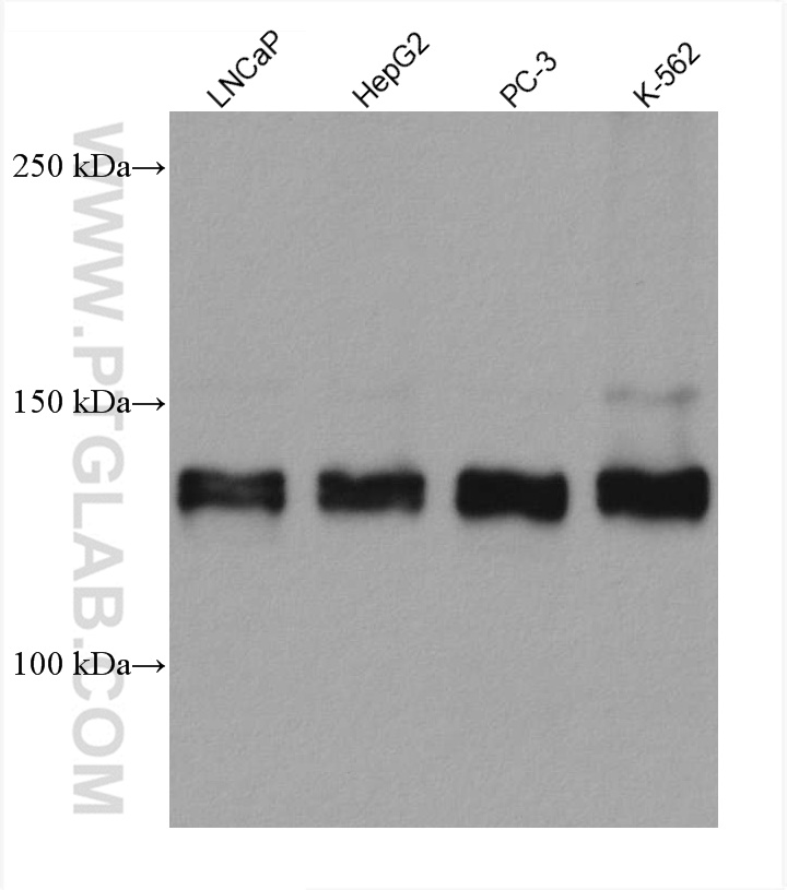 ZNF217 Monoclonal antibody