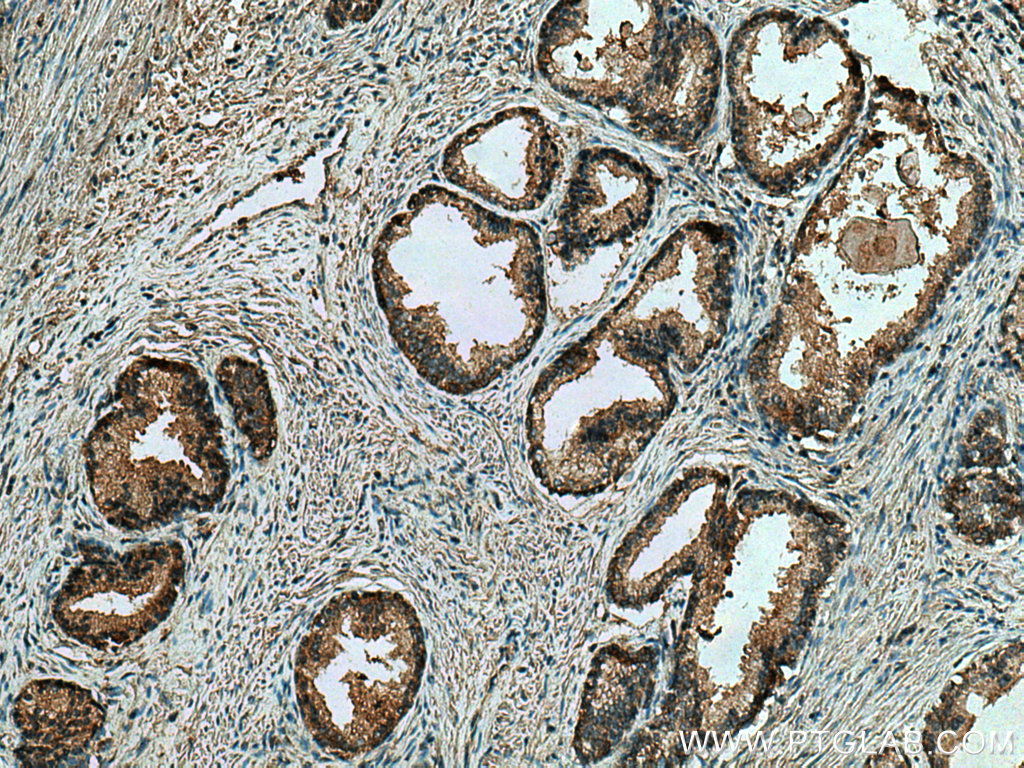 CTPS2 Monoclonal antibody