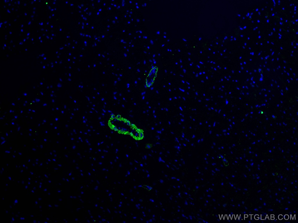 smooth muscle actin specific Monoclonal antibody