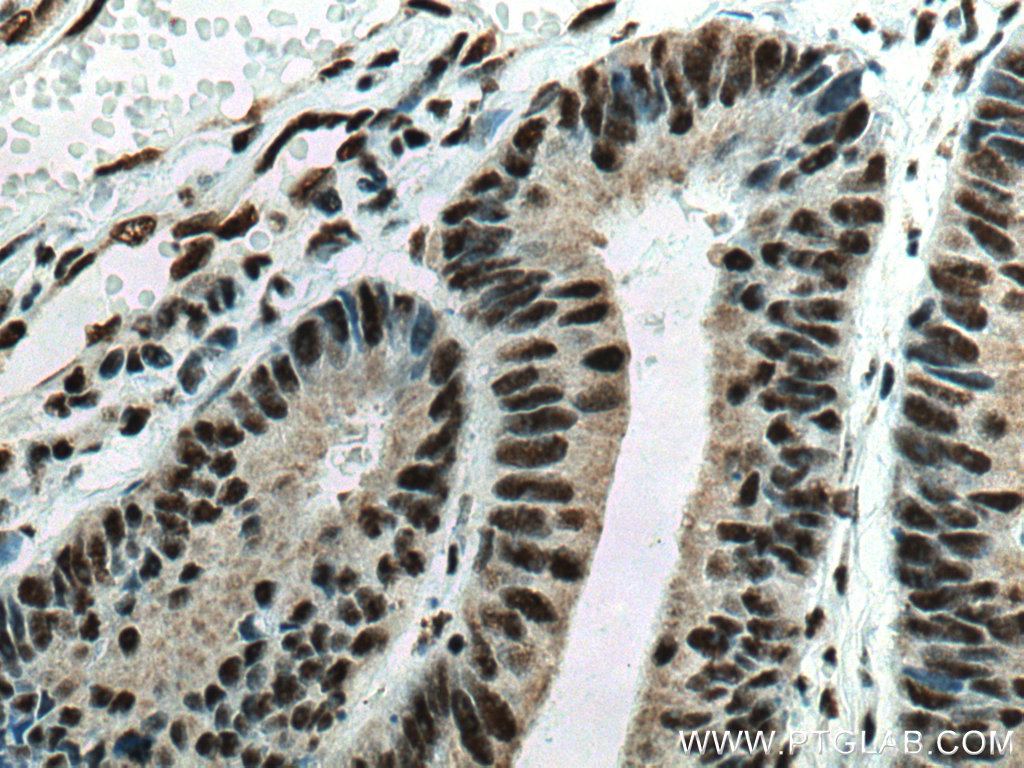 EIF4A3 Monoclonal antibody