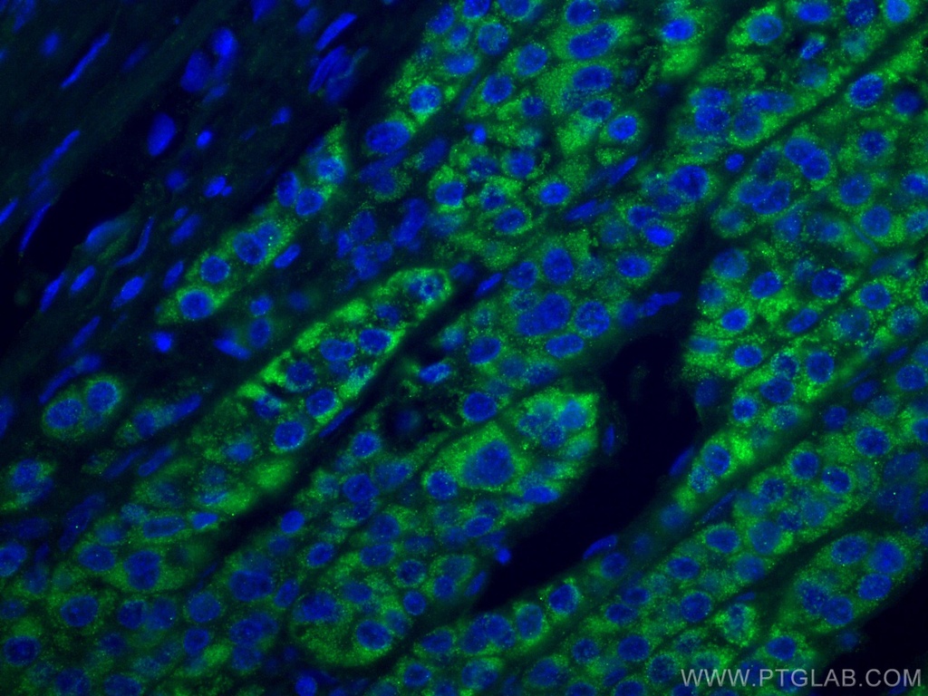 ACADM Monoclonal antibody