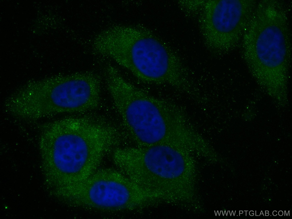USP14 Monoclonal antibody