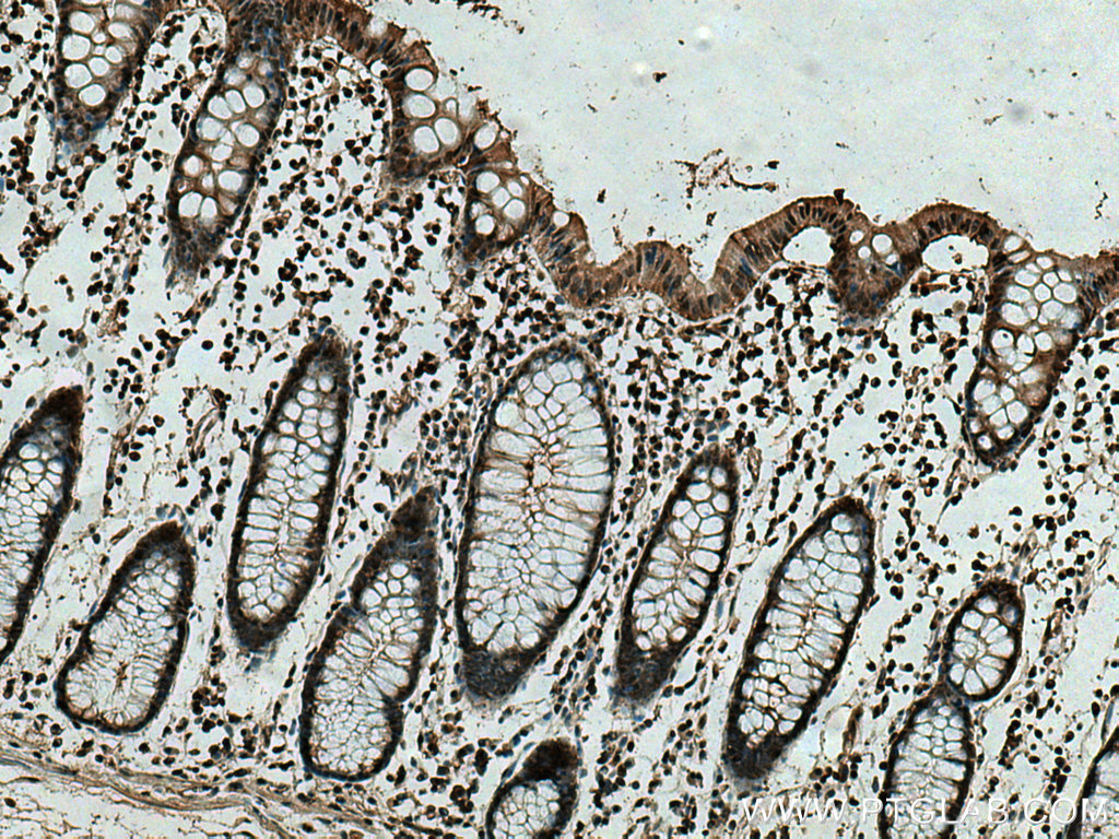 PSMB9 Monoclonal antibody