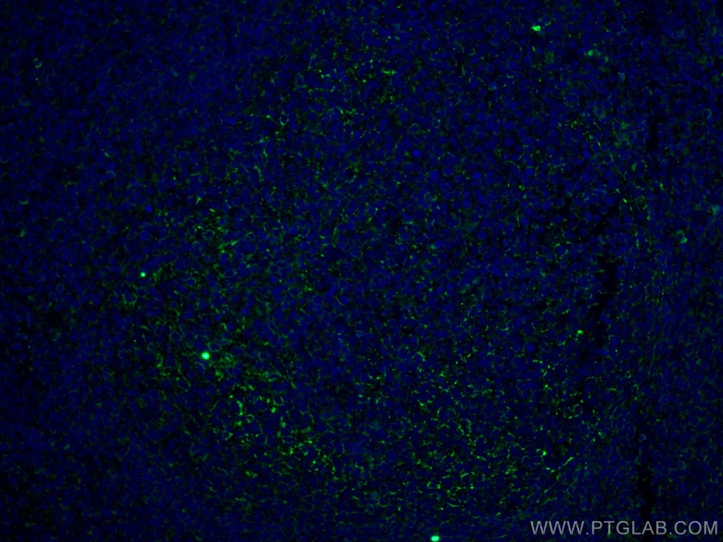 CD70 Monoclonal antibody