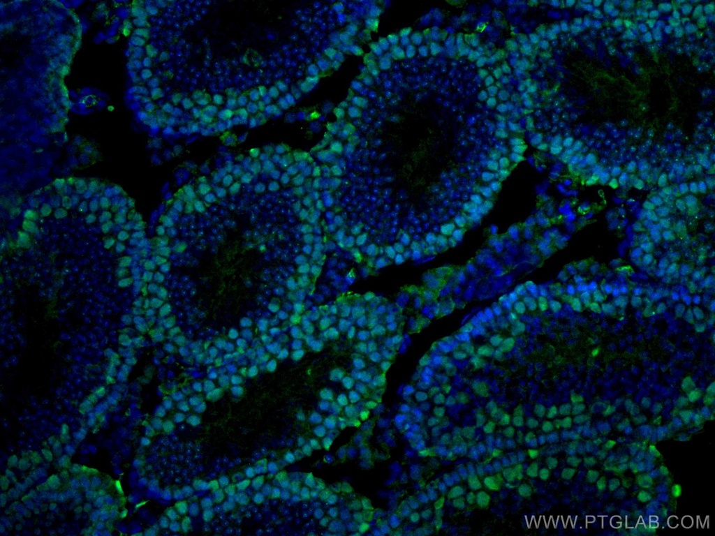 EED Monoclonal antibody