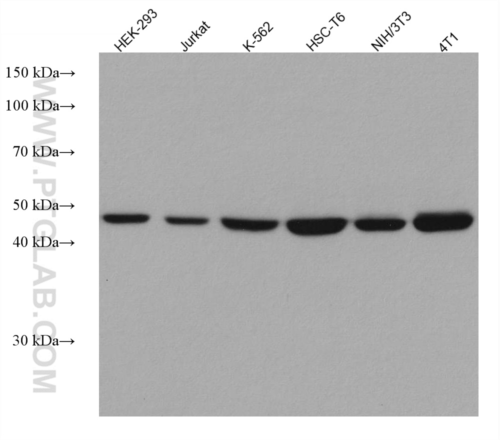 TRIP13 Monoclonal antibody