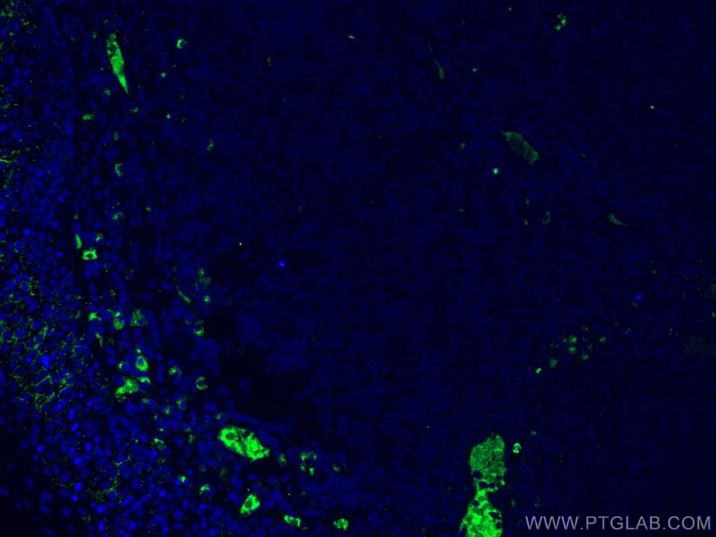 Human IgG Heavy chain Monoclonal antibody