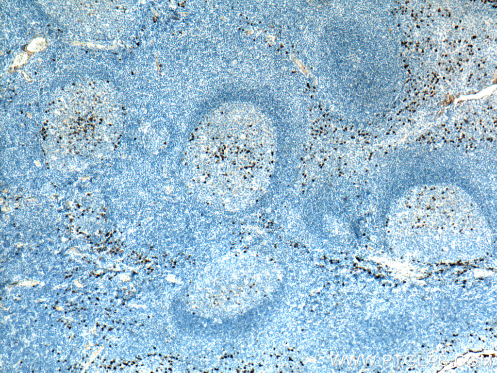 Human IgG Kappa chain Monoclonal antibody