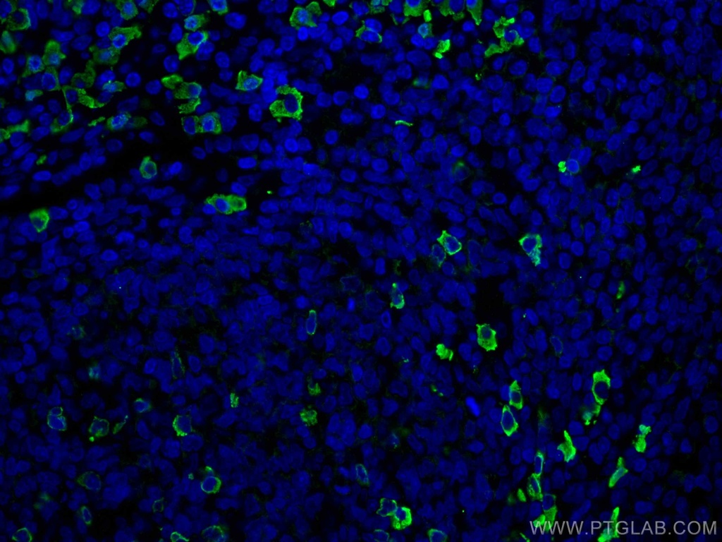 Human IgG lambda chain Monoclonal antibody