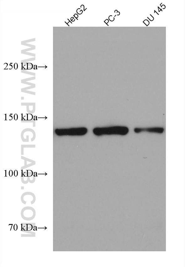 IL-6RB Monoclonal antibody