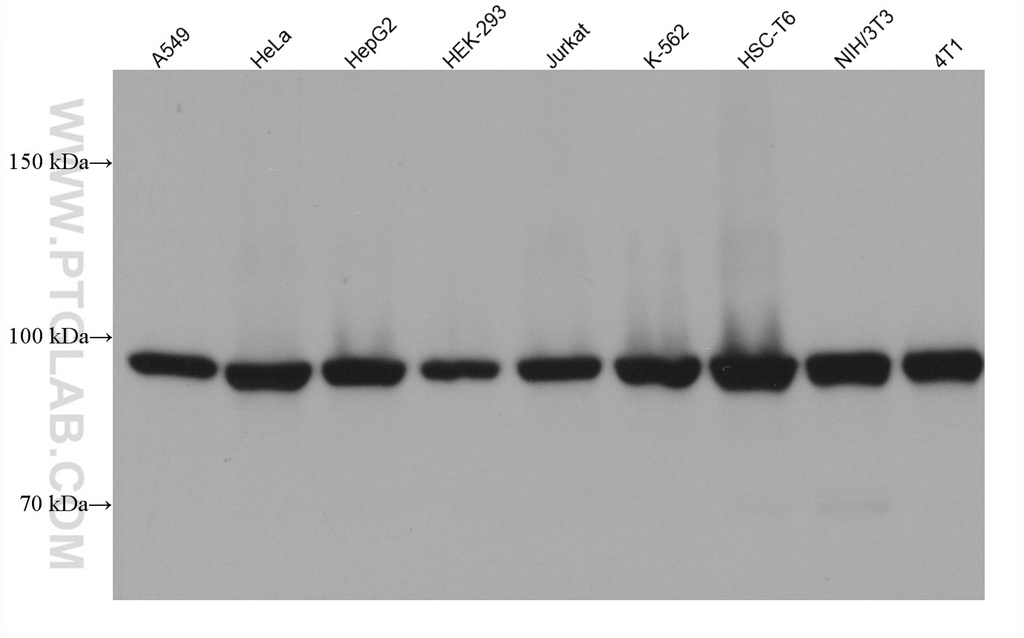 PSMD2 Monoclonal antibody