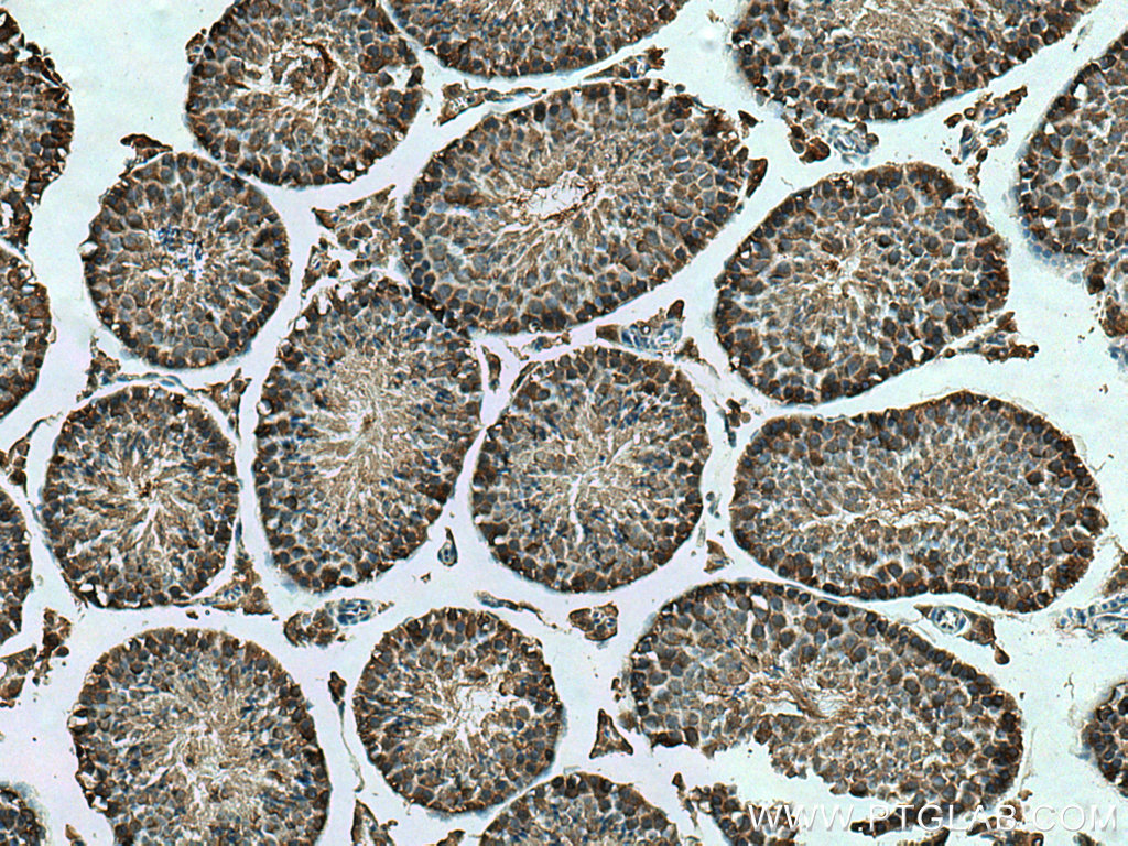 KLHL25 Monoclonal antibody