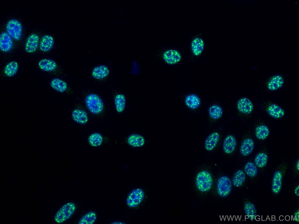 Phospho-mTOR (Ser2448) Monoclonal antibody