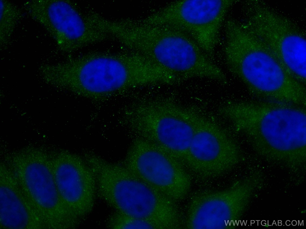 ABHD5 Monoclonal antibody