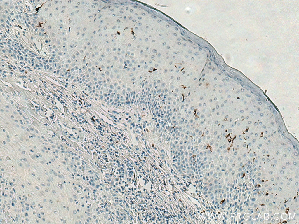 CD207 Monoclonal antibody