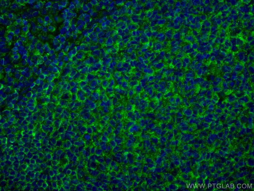NT5E,CD73 Monoclonal antibody