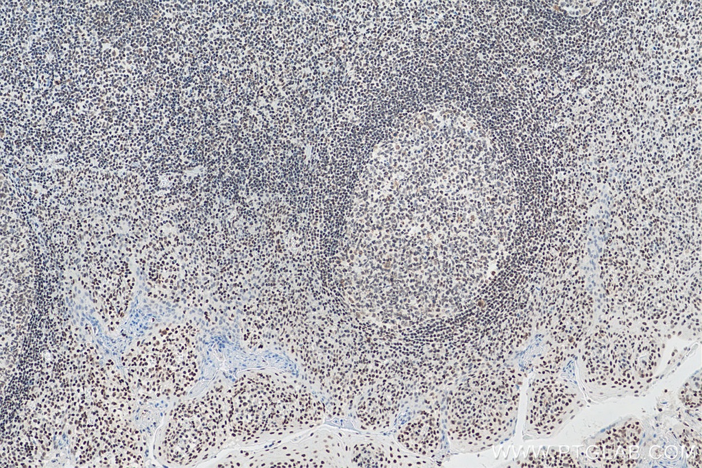 IFI16 Monoclonal antibody
