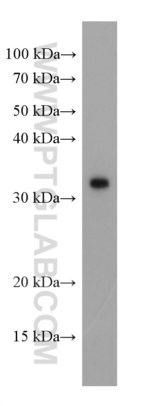 SARS-CoV-2 Spike Glycoprotein (944-1214 aa) Monoclonal antibody