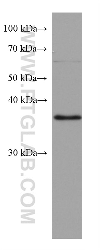 RP2 Monoclonal antibody
