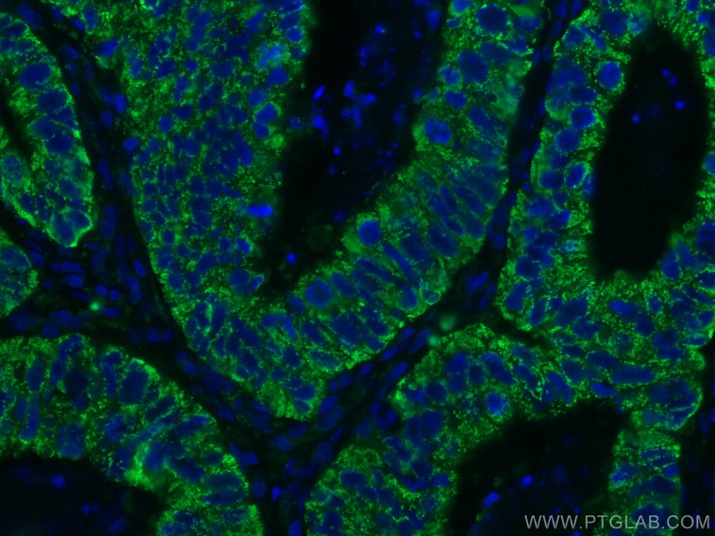 CNOT4 Monoclonal antibody