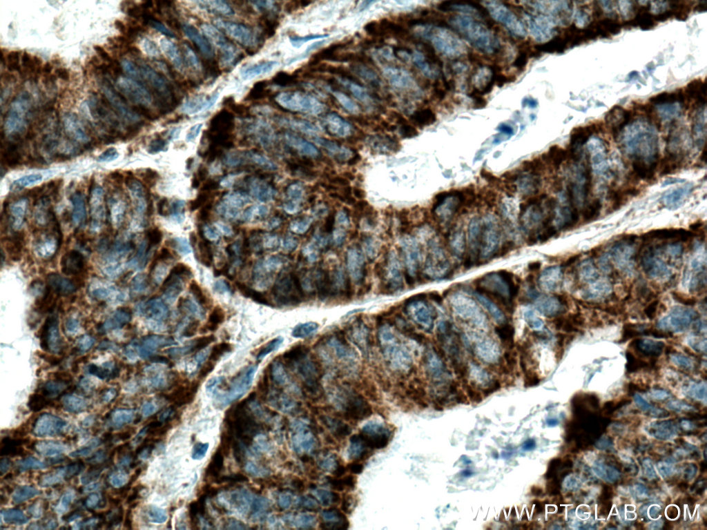 TUFM Monoclonal antibody