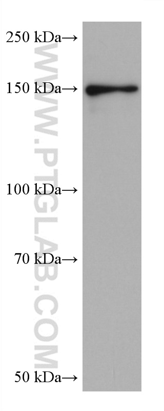 PPARGC1B Monoclonal antibody