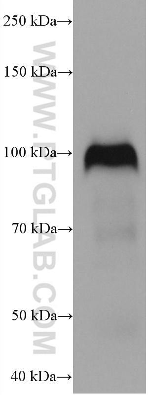 THBD Monoclonal antibody