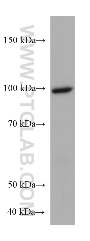 PDE6A Monoclonal antibody