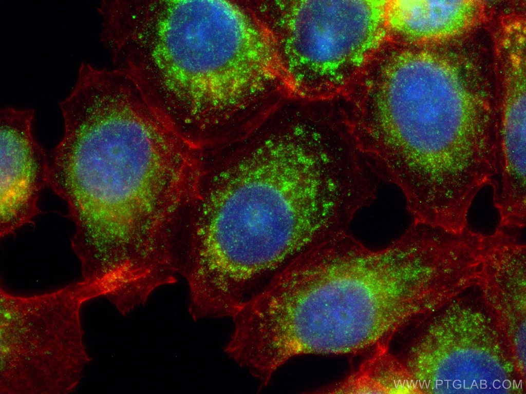 OXCT1 Monoclonal antibody