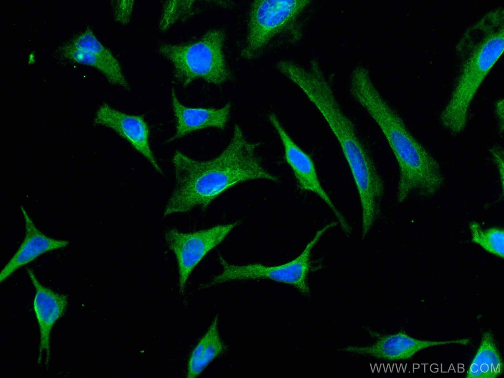 CIP2A Monoclonal antibody
