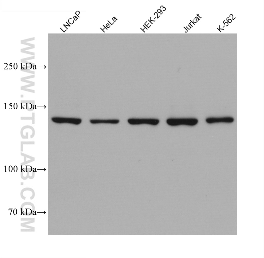 DHX37 Monoclonal antibody