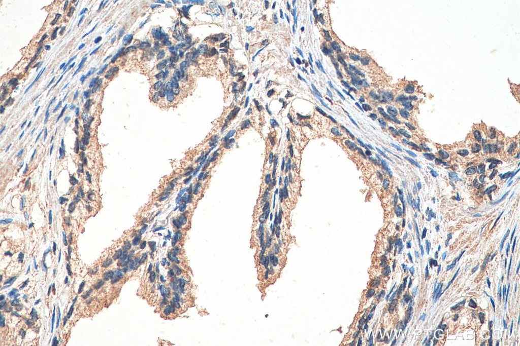 GIT2 Monoclonal antibody