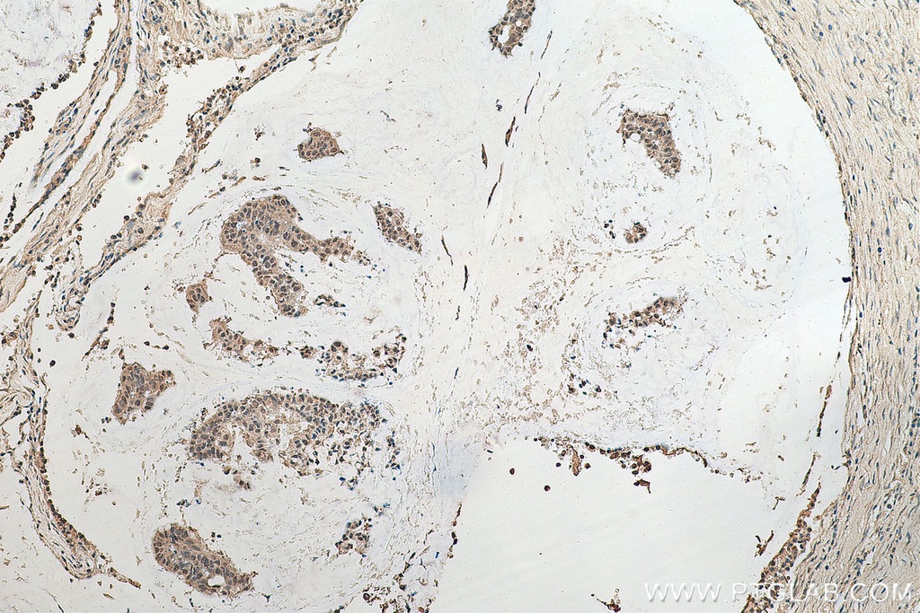 ASH2L Monoclonal antibody