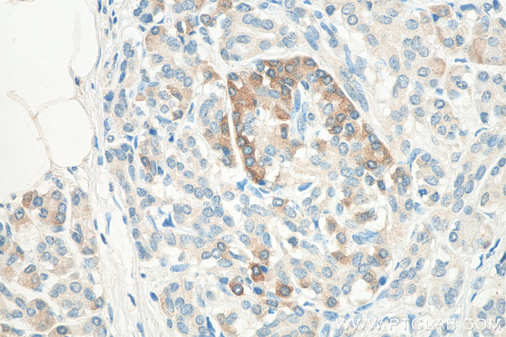 CBS Monoclonal antibody