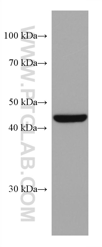 HSP47 Monoclonal antibody