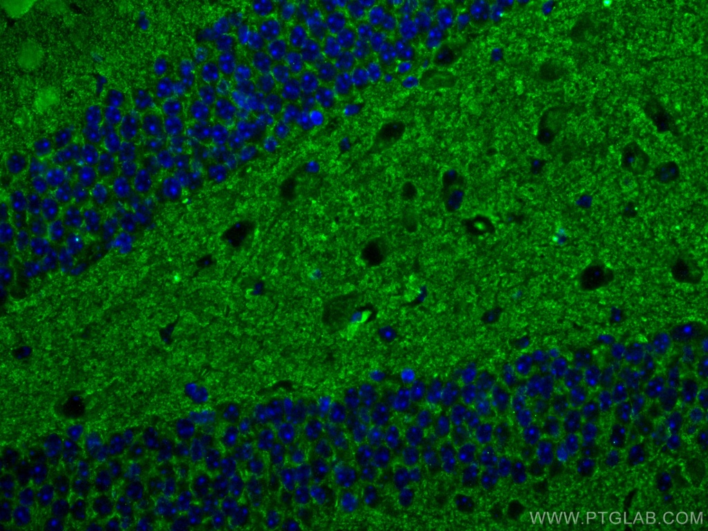 Synaptophysin Monoclonal antibody
