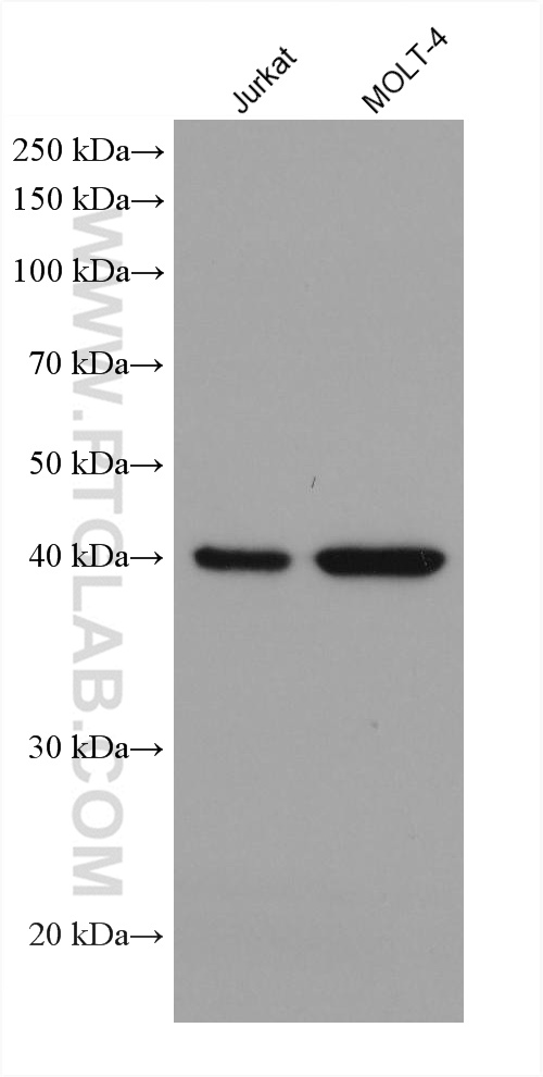 ADA Monoclonal antibody