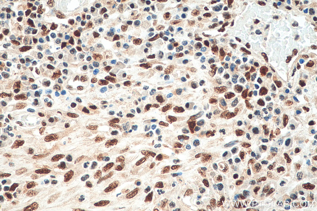 FKBP5 Monoclonal antibody