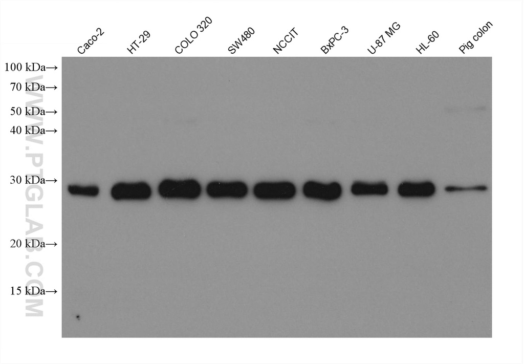 PLEKHB2 Monoclonal antibody