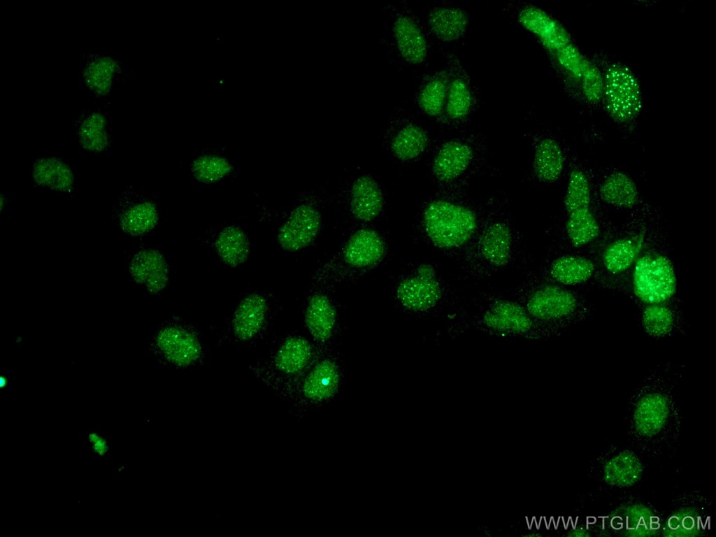 DAXX Monoclonal antibody