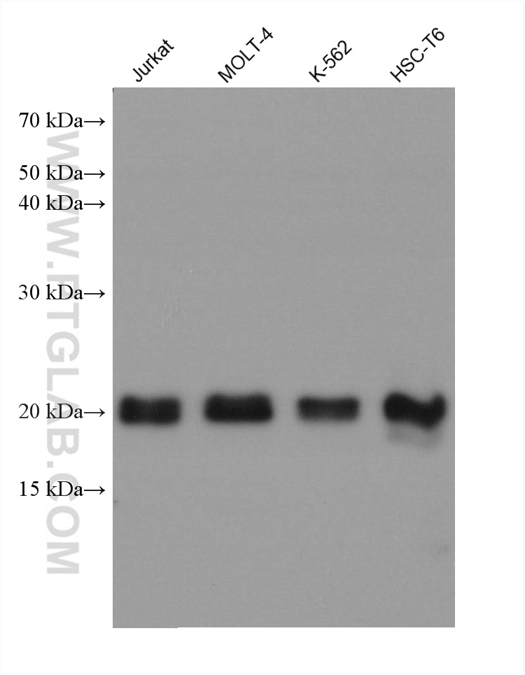 CBFB Monoclonal antibody